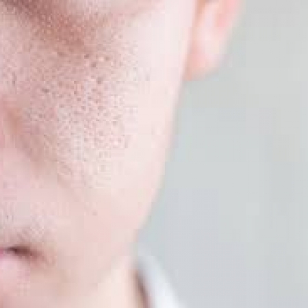 Mẹo Se Khít Lỗ Chân Lông Sau Waxing