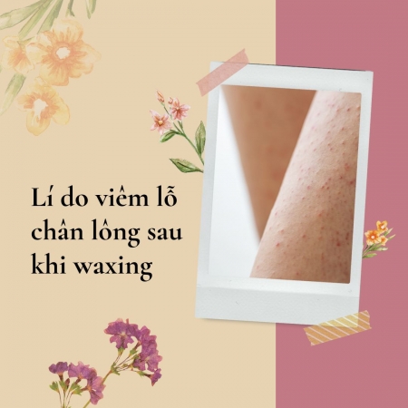 Những lý do dẫn đến viêm lỗ chân lông sau khi waxing và cách phòng tránh